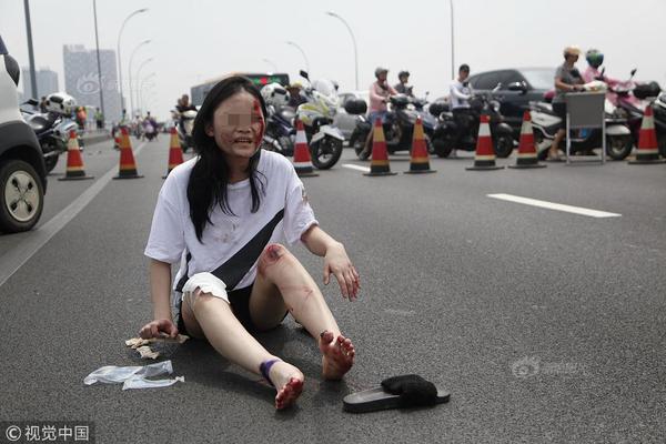 26岁男模走秀时突然跌倒猝死,身体健康的他死因令人生疑_CN2 GT线路特点