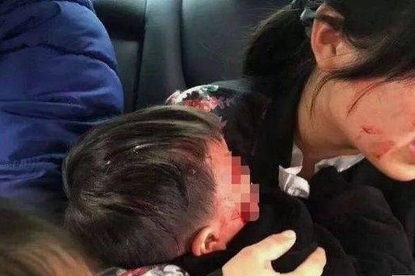 髂胫束不易拉伸 4个方法可缓解其疼痛_挂机宝CN2